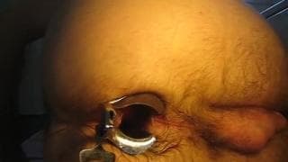 Opening my ass for you to see inside Opening my ass for you to see inside